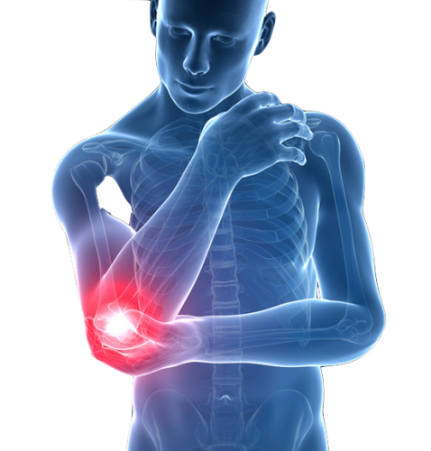 Lateral Epikondilit